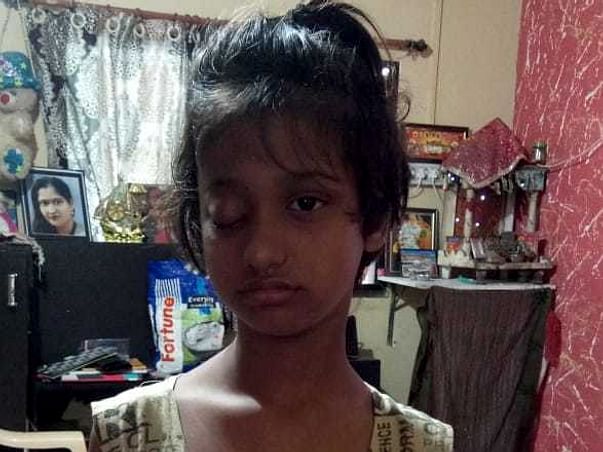 Help My Daughter Undergo Eye Cancer