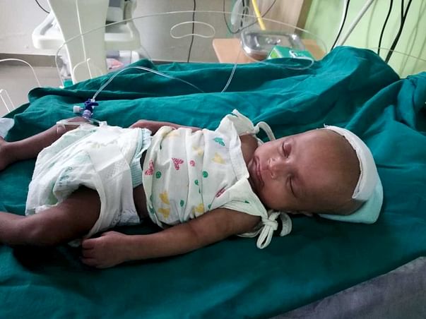 Help BABY recovery from cerebral Abscess
