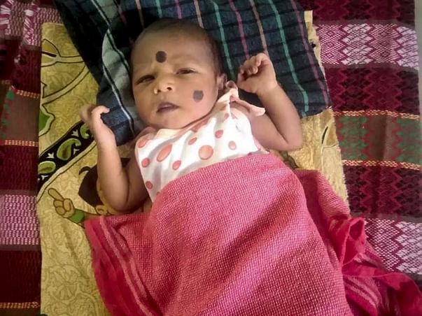 Save 24 Days Old Baby With Heart Complication