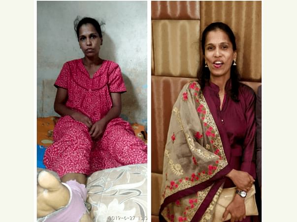 Lets Support Sakshi patil to stand on her feet