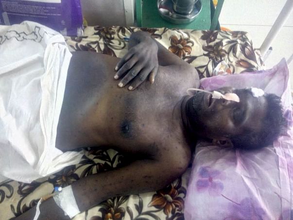 Help Johny Asari for surgery