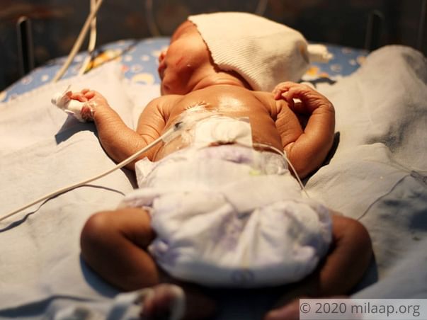 Help Baby of Rupabai Recover From Severe Dyselectrolytemia