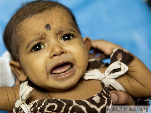 Help Baby Mokshada Fight Biliary Atresia