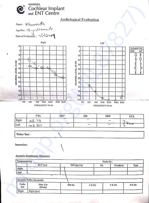 Audiological Evaluation