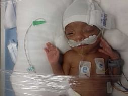 Plz Help My Twin Babies Recovery, Born Prematurely. Plz support 🙏 🙏