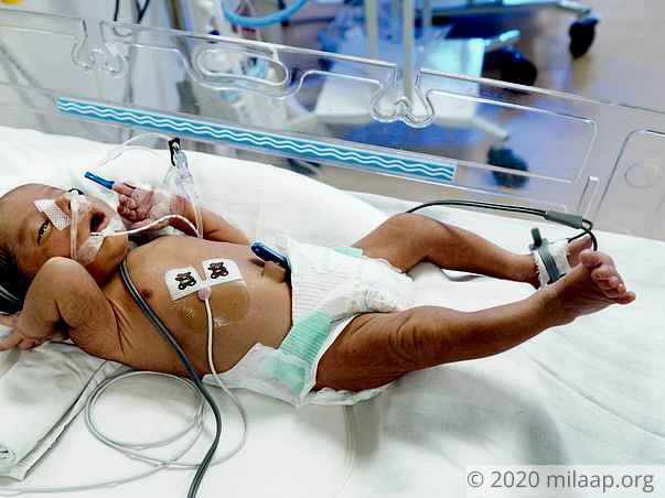 Baby of Renu needs your help to survive