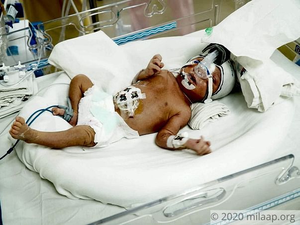 Baby of Teeja needs your help to survive