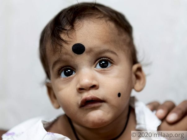 Help Aravind Naik Undergo A VSD Closure Surgery