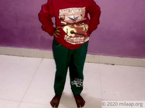 Help Nutan Vishal Fight Hepatitis A with ALF