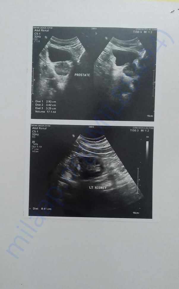 Sonography