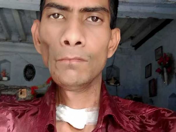 Help Ashok Recover From Mouth Cancer
