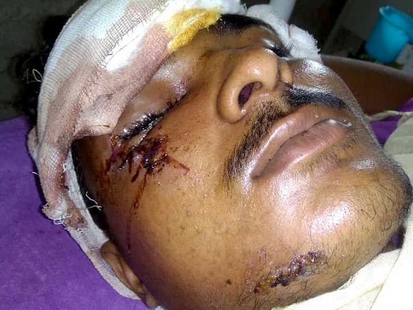 Help Neeraj Recover From An Accident