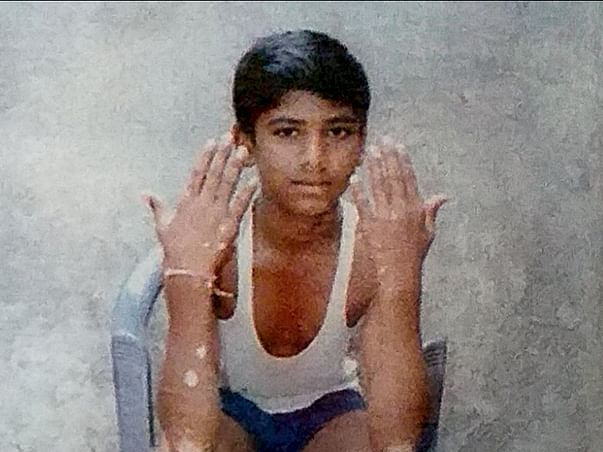Please help Revannath to Fight Against skin diseases