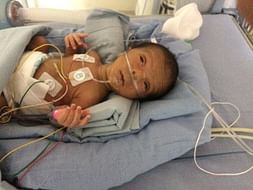 Help Preterm Baby Survive