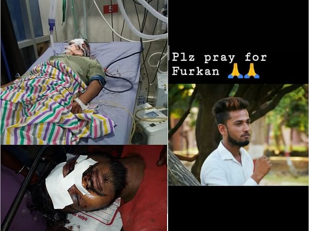 Help the Brother of an RTE student, who met with an accident!