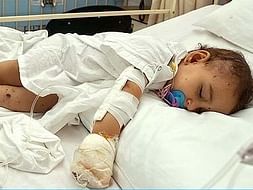 Help My Little Daughter Recover from a Fatal Accident