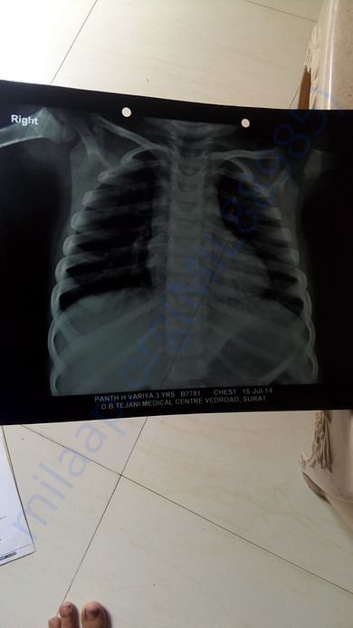 MEDICAL REPORTS X-RAY FOR ASTHAMA