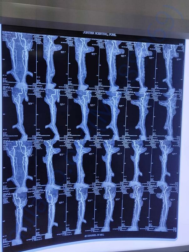 mri scan