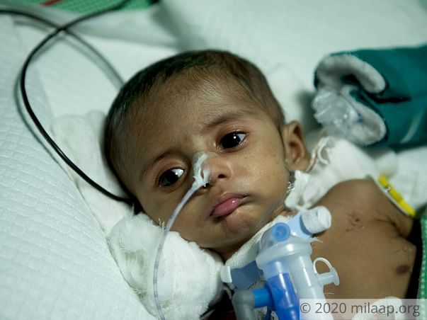 Help Baby of Haritha Rani Undergo VSD Closure
