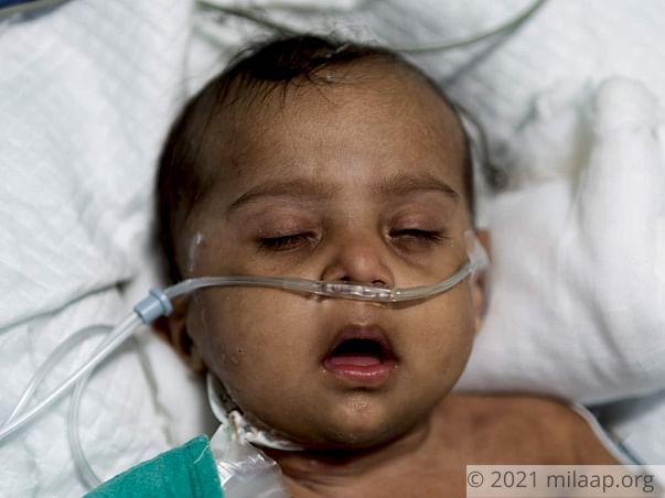Help Baby of Chandra Shakar Recover From Pneumonia