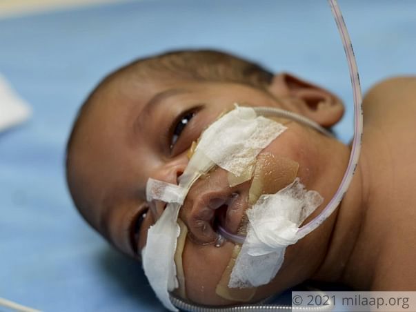 Help Baby of Priyanka Survive