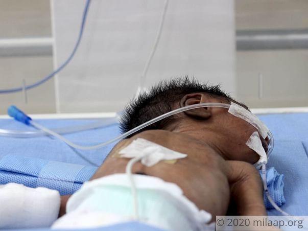 Help Baby of Saranya Recover