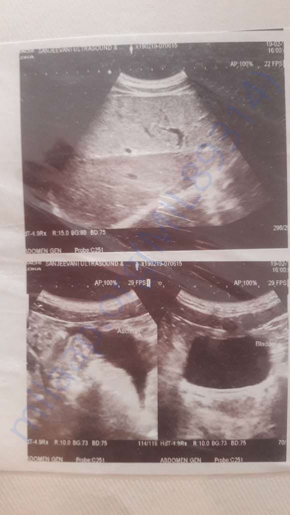 ultrasound