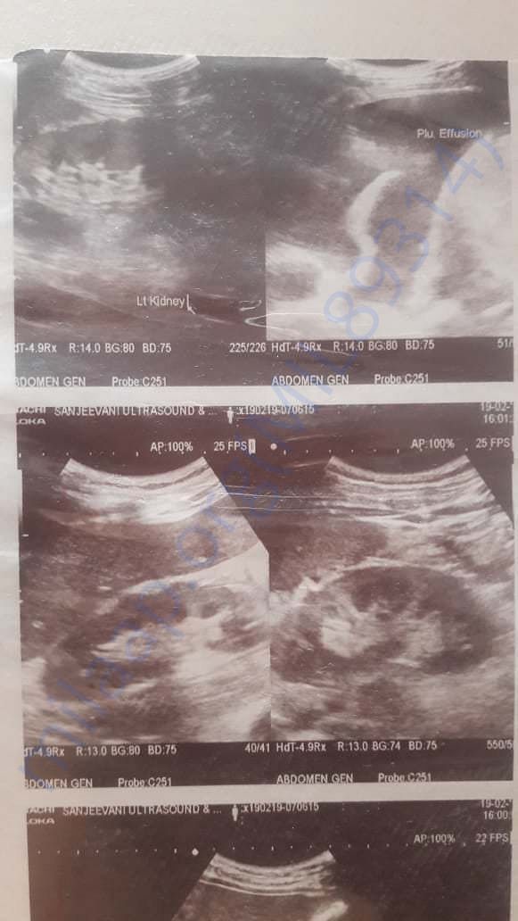 ultrasound