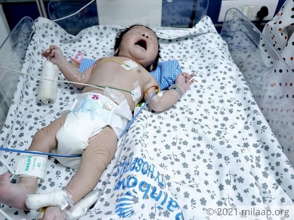 Help Baby of Sirisha Undergo Arterial Switch Operation