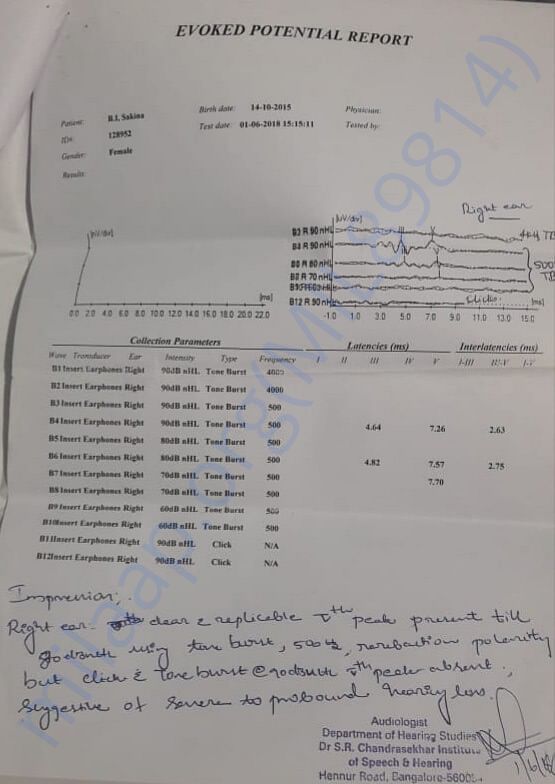 Right ear report