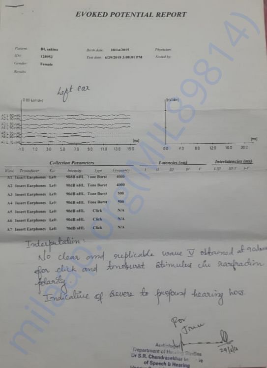 Left ear hearing report