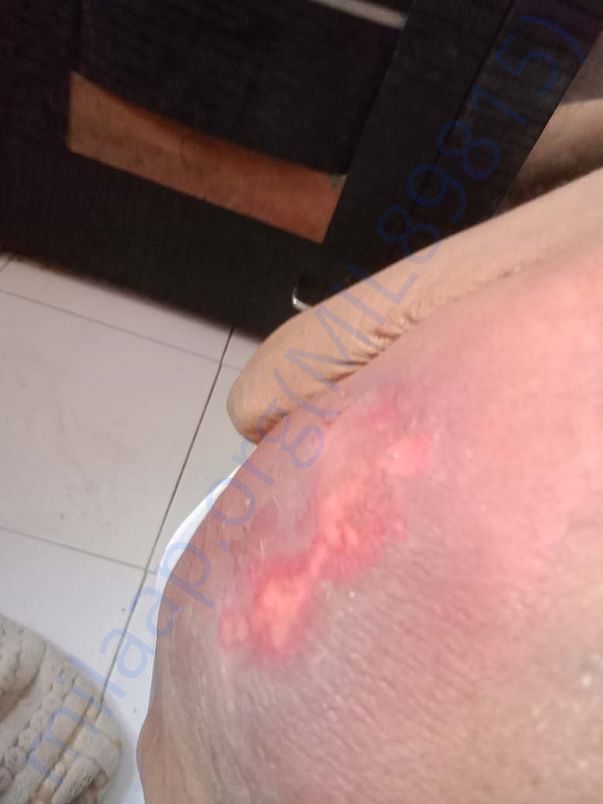Disease