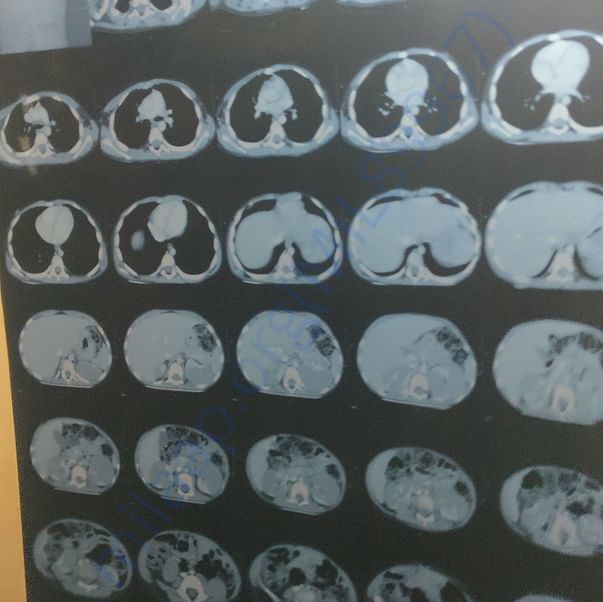 Medical Report