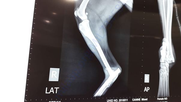 Xray ----- 1