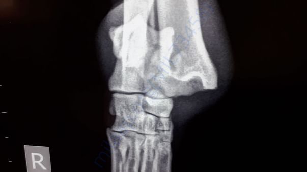Xray ----- 2