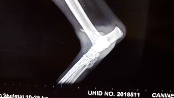 Xray ----- 3