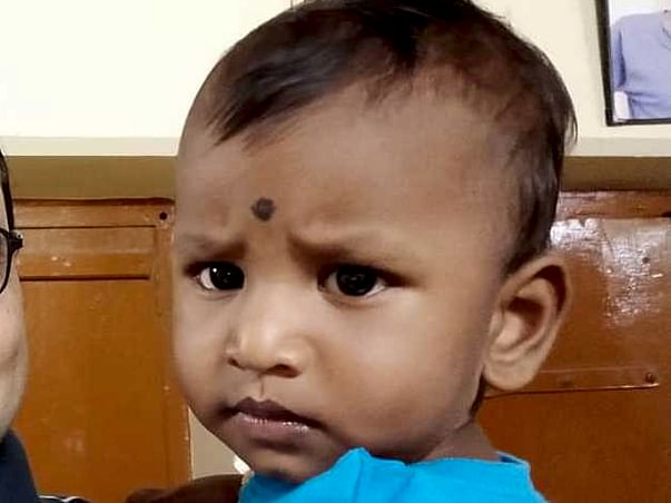 Help 1.6 Years Old Kid Praneeth Undergo Open Heart Surgery