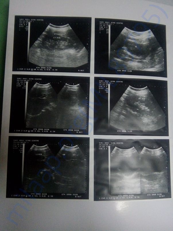 Scan