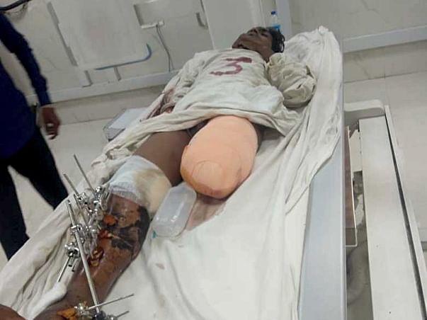 Help Sachin Who Met With A Severe Road Accident.