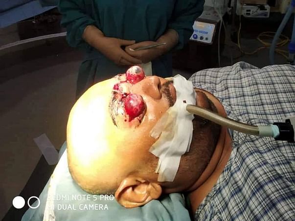 Anup needs your help