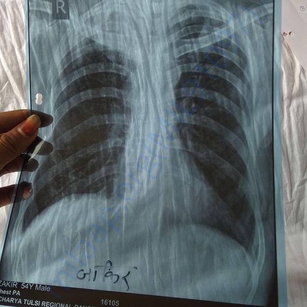 Medical Report