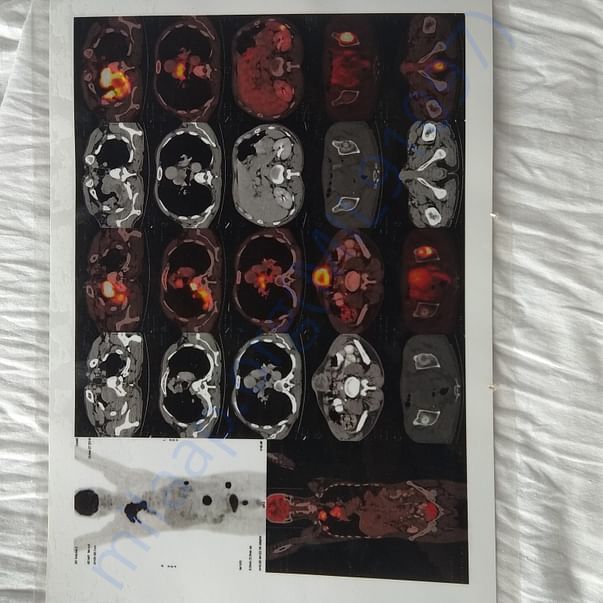 Medical Report