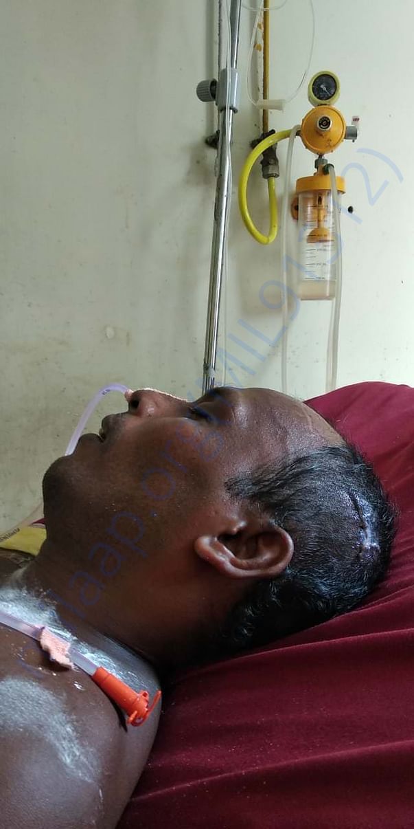 File photo of patient after discharged from ICU