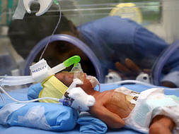 Support Baby of Manjula Recover From Respiratory distress syndrome