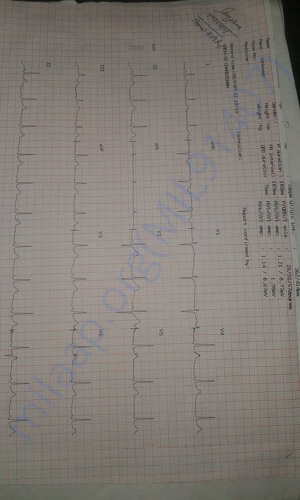 ECG report
