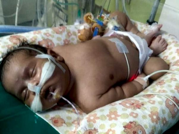Please Save My New Born Baby (41 days old)