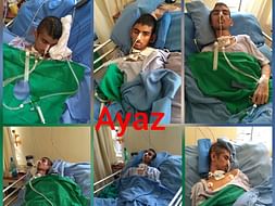 Help for my elder brother who had met with an major accident