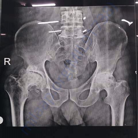 Medical Report