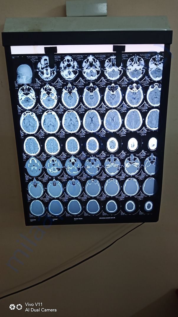 brain MRI
