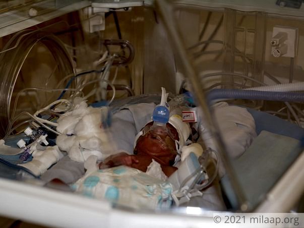 Help Baby of Mekala Survive